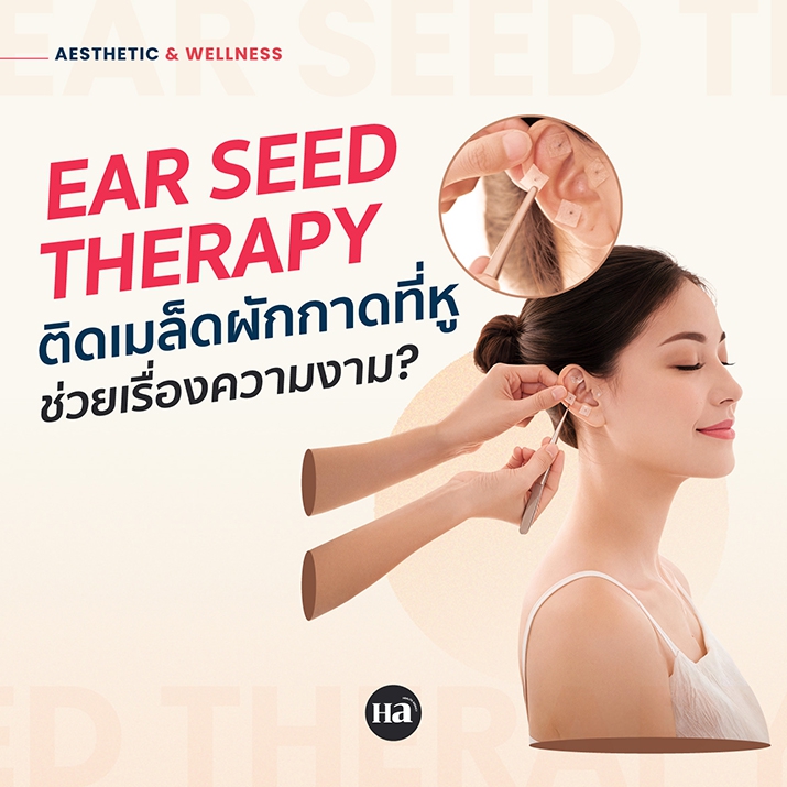 Ear Seed Therapy คืออะไร? ติดเมล็ดผักกาดที่หู ช่วยสวยและบาลานซ์ร่างกายจริงไหม